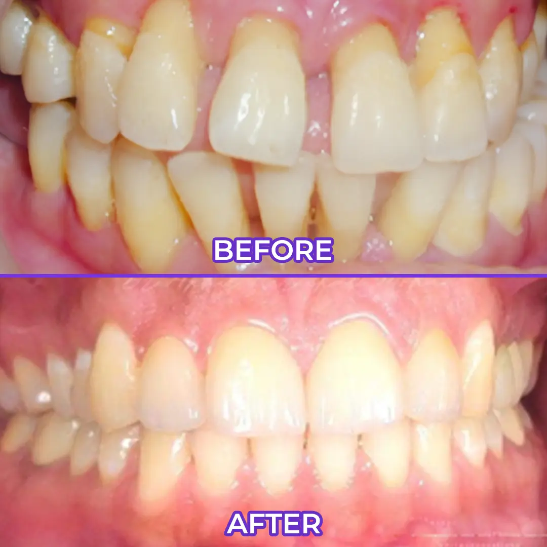 SEAGRIL® Fluoride Toothpaste