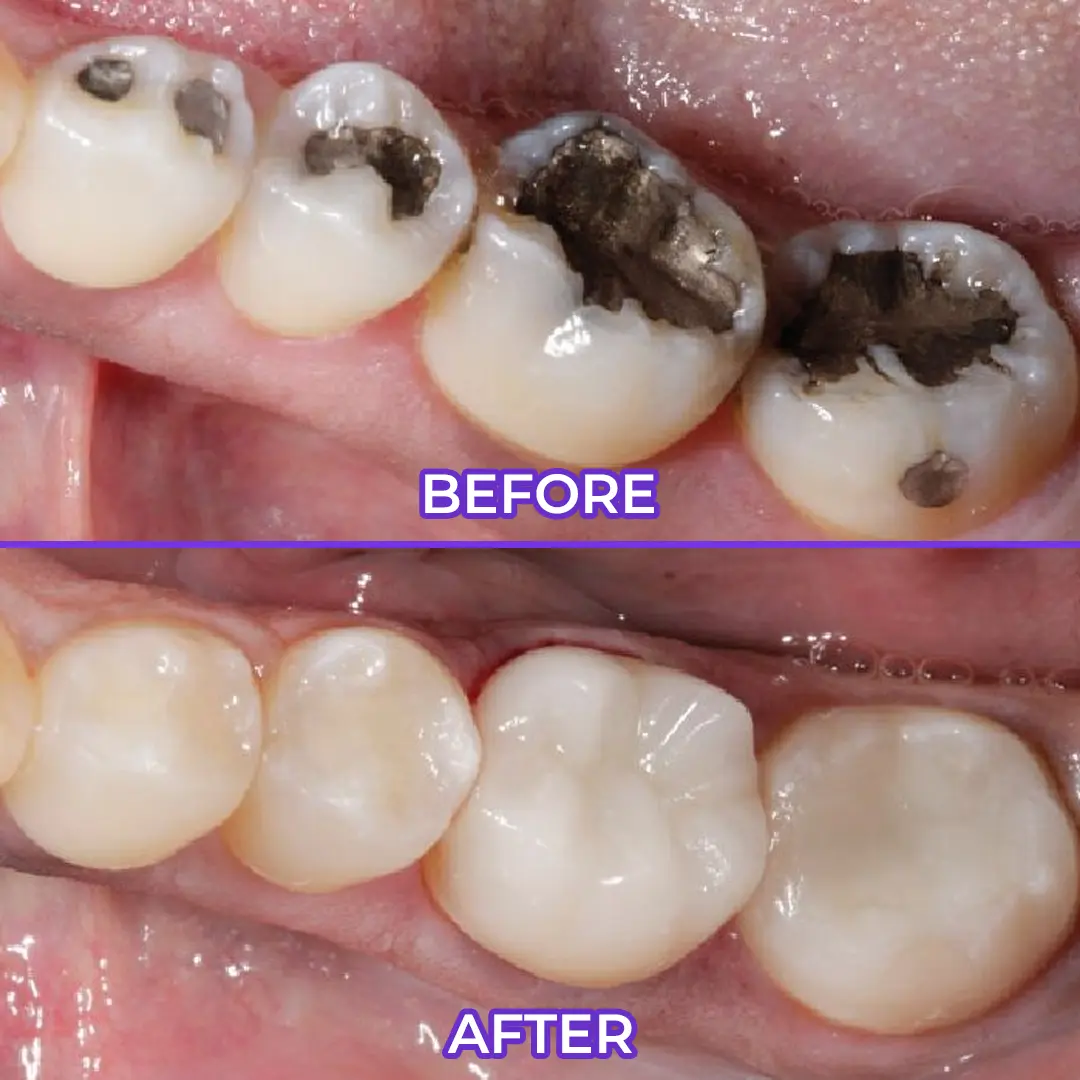 SEAGRIL® Fluoride Toothpaste