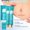 ๐ฟSEAGRILโข Scar Repair Cream|Treats Old and New Scars, Burns and More