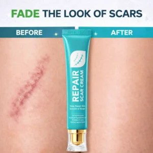 🌿SEAGRIL™ Scar Repair Cream|Treats Old and New Scars, Burns and More