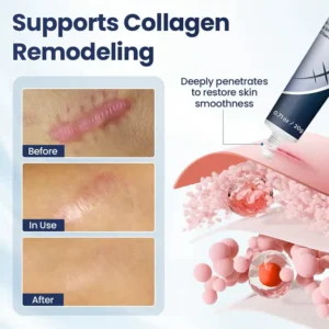 SEAGRIL® Texture Repair Gel