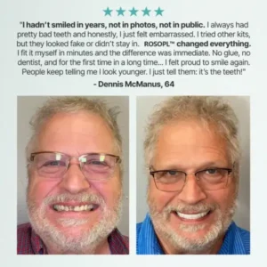 Shinneey™ Custom-Fit Functional Dentures