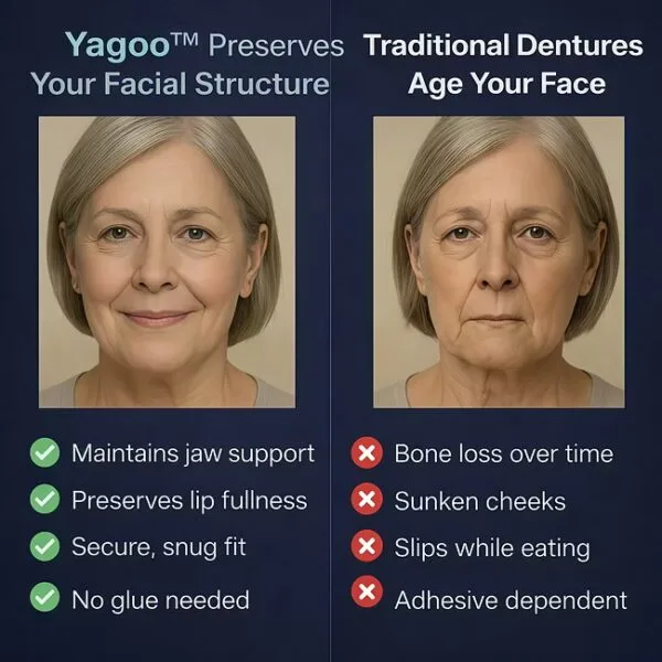 Yagoo™ Second-Generation Complete Denture Set