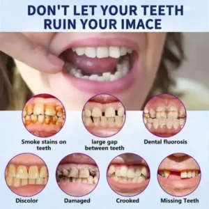 https://skavix.net/product/vaxflite-full-denture-set-upper-lower/