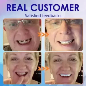https://skavix.net/product/vaxflite-full-denture-set-upper-lower/