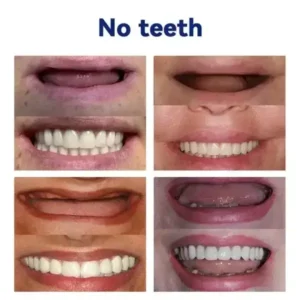 https://skavix.net/product/vaxflite-full-denture-set-upper-lower/