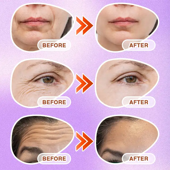 CareBreeze® 3-in-1 Microneedle Anti-Aging Patch