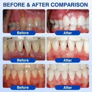 Dr.Era® GumRevive Periodontal Repair Gel
