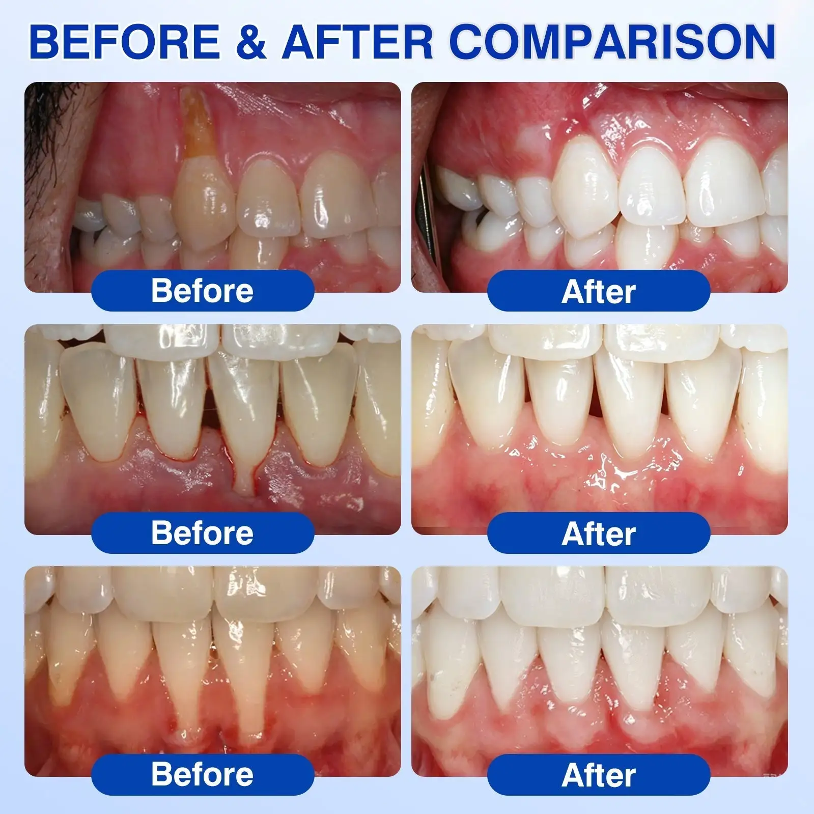 Dr.Era® GumRevive Periodontal Repair Gel