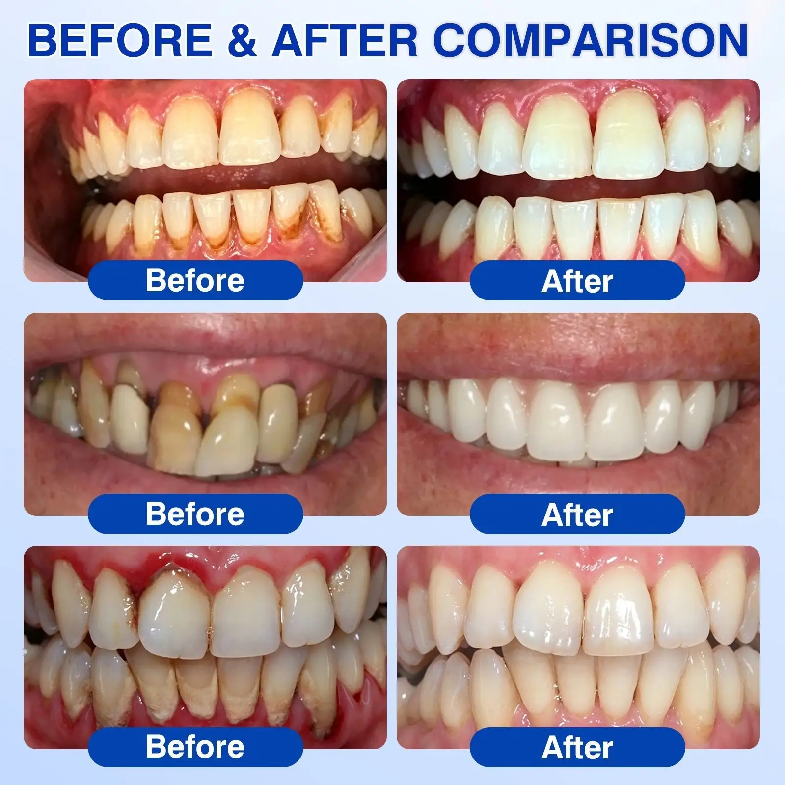 Dr.Era® GumRevive Periodontal Repair Gel