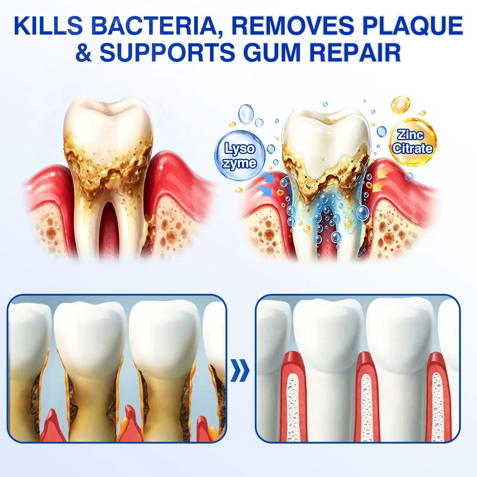 Dr.Era® GumRevive Periodontal Repair Gel