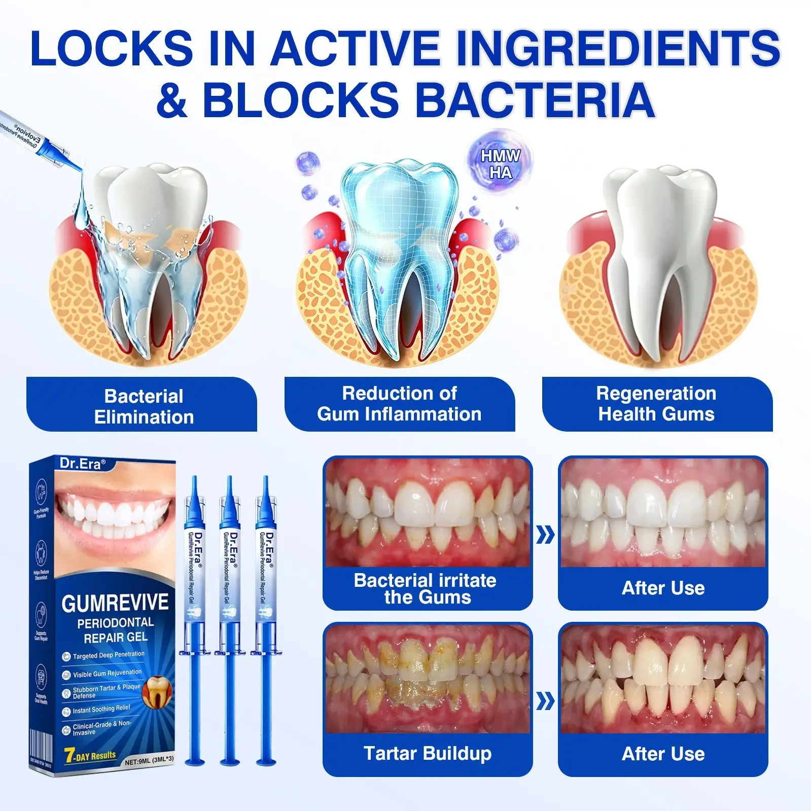 Dr.Era® GumRevive Periodontal Repair Gel
