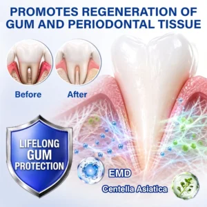 Glimmerly® GumRevive Periodontal Repair Gel