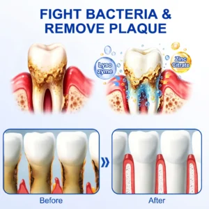 Glimmerly® GumRevive Periodontal Repair Gel