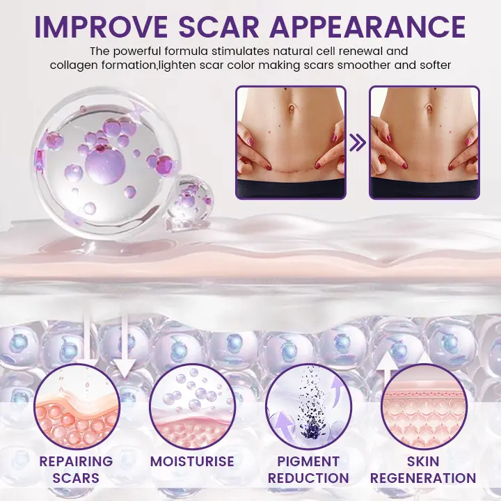SEAGRIL® Stem Cell Scar Gel